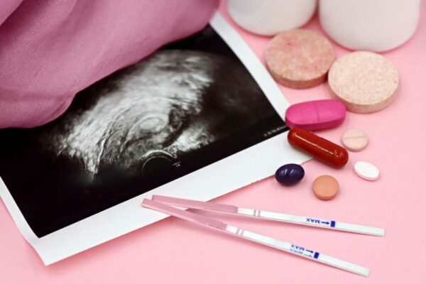 Endometriosi: comprendere la malattia e prendersi cura di sé con consapevolezza